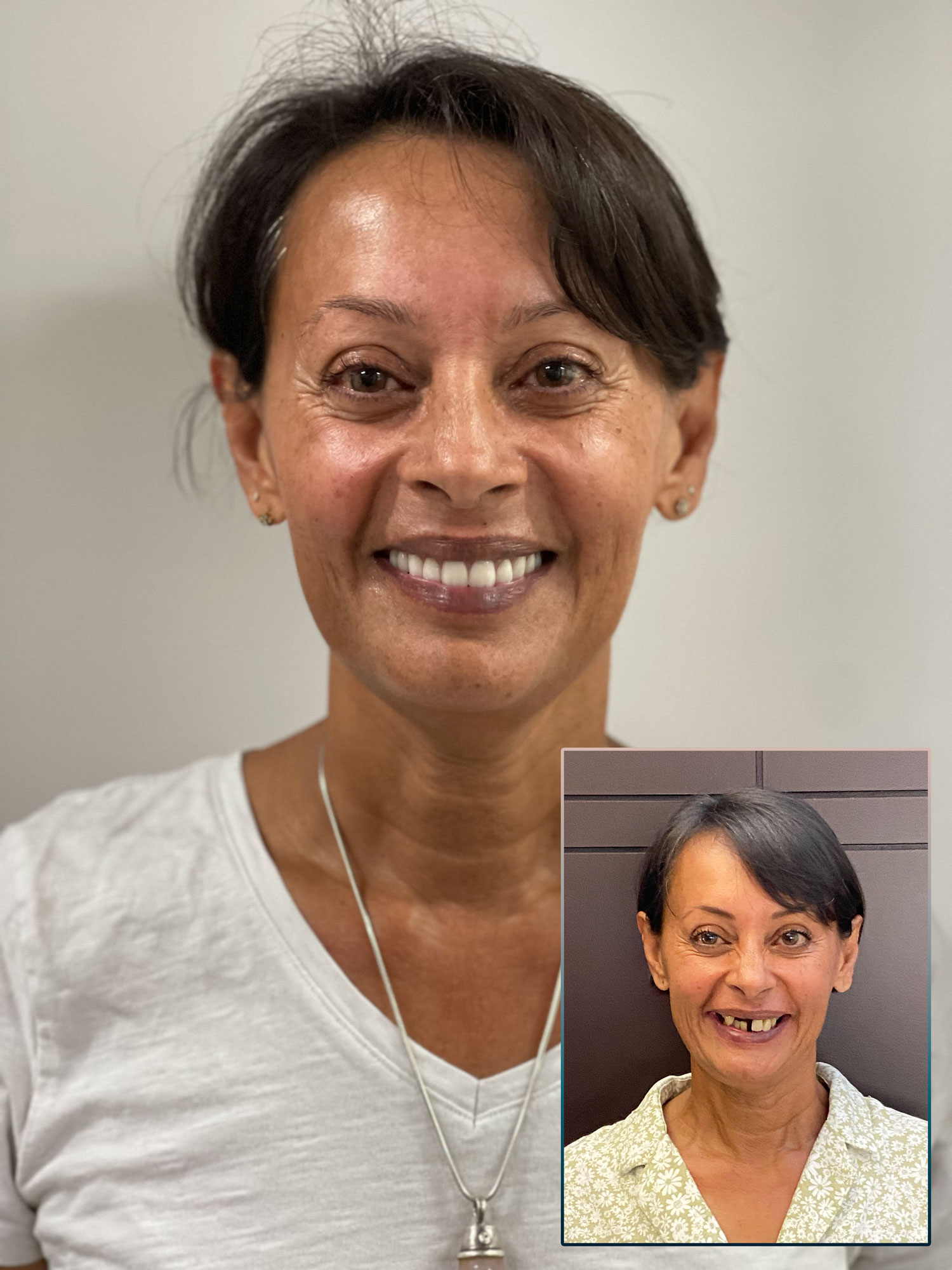 Aesthetic Dentistry